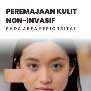 PEREMAJAAN KULIT NON-INVASIF PADA AREA PERIORBITAL