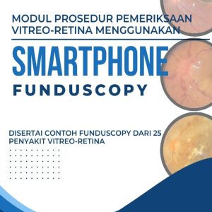 Modul Prosedur Pemeriksaan Vitreo-Retina Menggunakan Smartphone Funduscopy