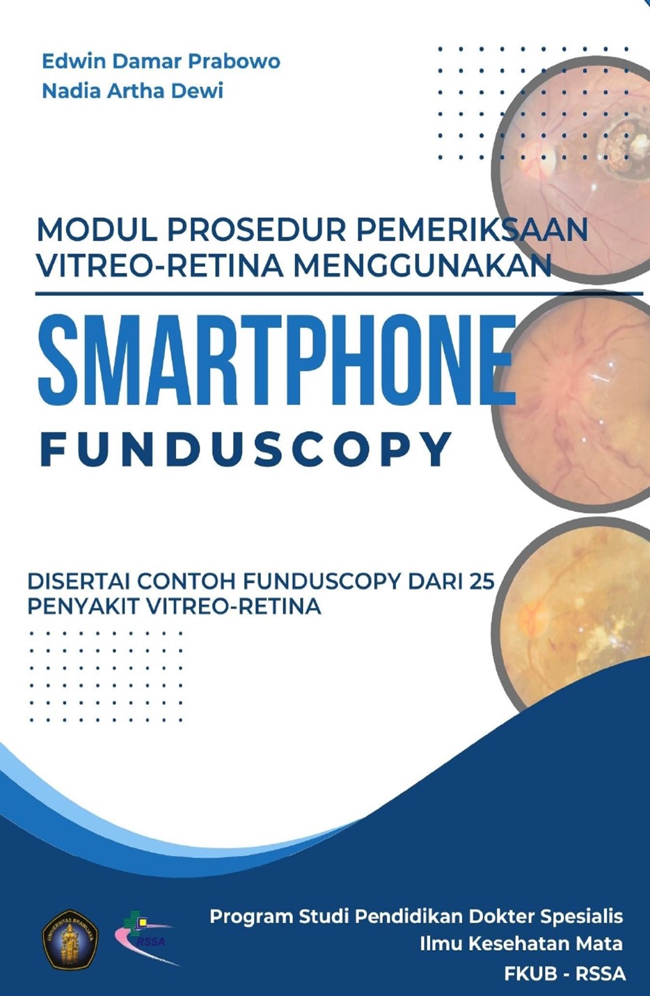 Modul Prosedur Pemeriksaan Vitreo-Retina Menggunakan Smartphone Funduscopy